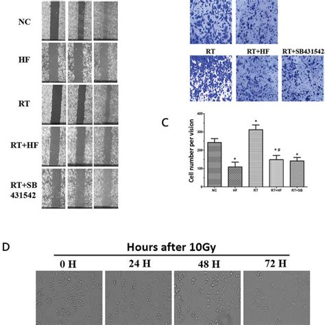 Migration and Wound healing assays. A. Wound healing assay to compare ...