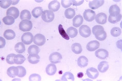 Free picture: blood smear, micrograph, plasmodium falciparum, parasite ...