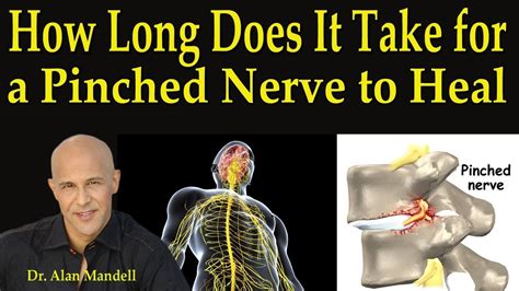 Review Of Pinched Nerve In Neck And Shoulder Treatment At Home References