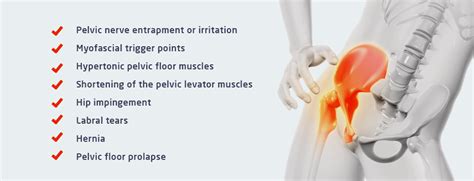 Myofascial Release Pelvic Floor Dysfunction | Viewfloor.co