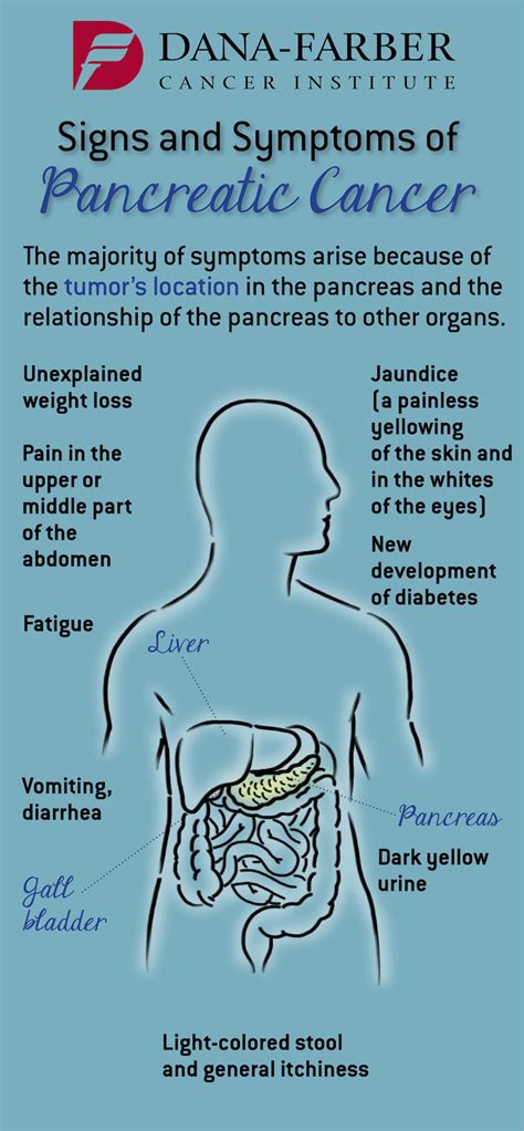 Pancreatic Cancer: What are the Signs and Symptoms? | Dana-Farber ...