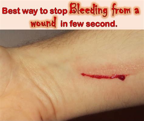 Best way to stop Bleeding from a wound in few second - Dr Aainy