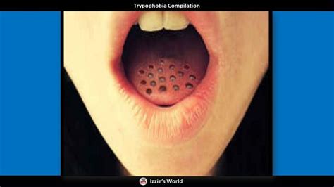 Pin on Trypophobia Images