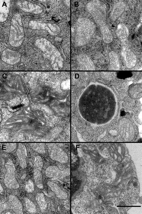 Electron microscopy reveals cristae remodeling within mitochondria of ...