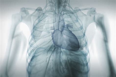 Left Atrial Enlargement Causes and Prognosis