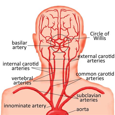 carotids Subclavian Artery, Vertebral Artery, Carotid Artery, Brain ...