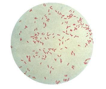 Pseudomonas aeruginosa - microbewiki