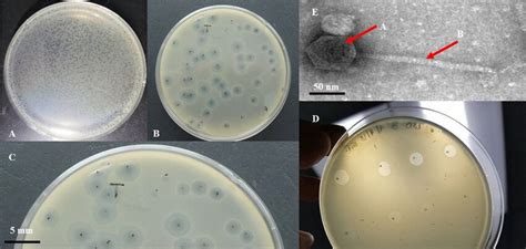 The presence of bacteriophage in the studied sample. A, B, and C ...