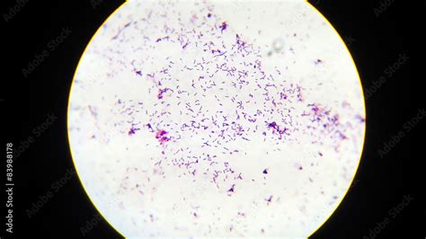 bacteria Gram staining under microscope Stock Photo | Adobe Stock