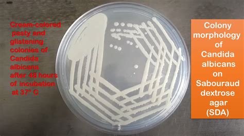 Sabouraud Dextrose Agar (SDA) Sharebiology, 58% OFF