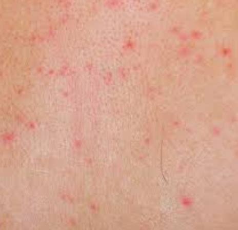 Red spots on skin