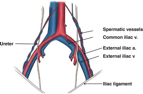 External Iliac Artery