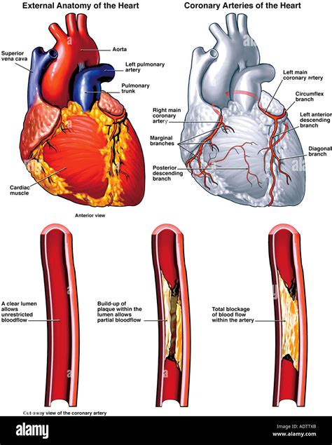 Coronary Artery