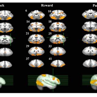 | Response inhibition associated brain regions. Brain activations ...