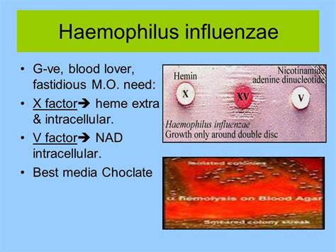 Antibiotics for haemophilus