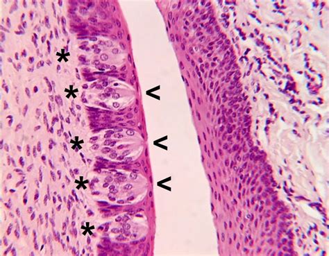 Tongue Histology Taste Buds