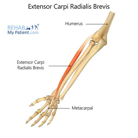 Extensor Carpi Radialis Brevis Muscle With Arm And Hand Bones Outline ...