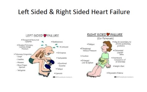 Exemplar 16.F Heart Failure - Pearson Flashcards | Quizlet