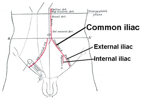 External iliac artery - Wikipedia