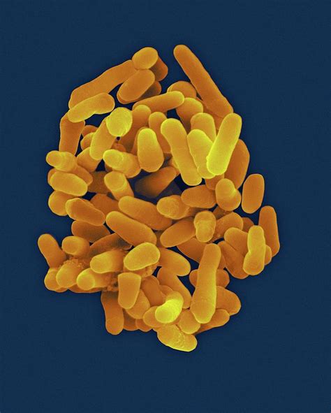 Mycobacterium Tuberculosis #6 Photograph by Dennis Kunkel Microscopy ...