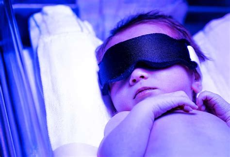 Phototherapy for Treating Neonatal Jaundice: Process, Risks & Complications