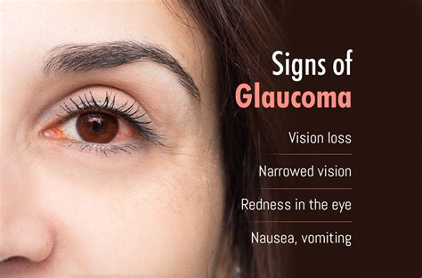 Signs of Glaucoma