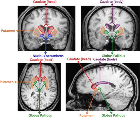 The Potential Role of the Striatum in Antisocial Behavior and ...