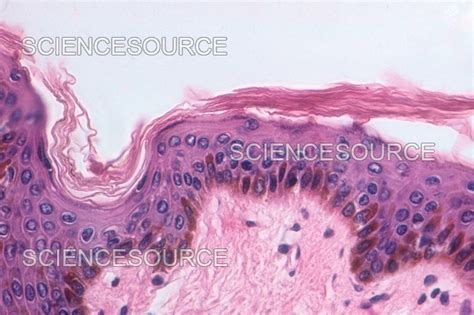 Keratinized Stratified Squamous Epithe | Stock Image - Science Source ...