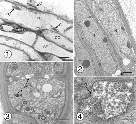 Transmission electron micrographs showing phloem cells of various types ...