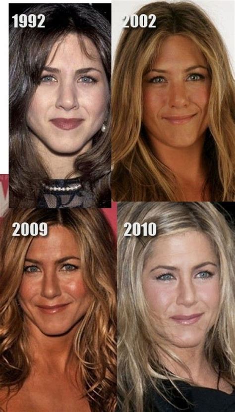 Nose Job Before and After by Jennifer Aniston : Project Of Nose ...