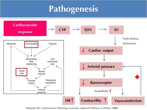 Hemorrhagic Shock