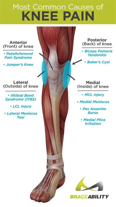 The Most Common Causes of Anterior, Posterior, Medial, and Lateral Knee ...