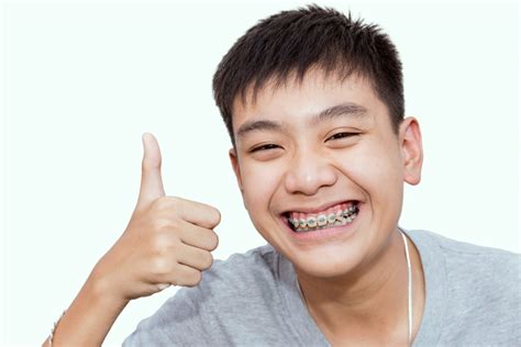 Guide 101 - Everything to Consider About Braces for Kids