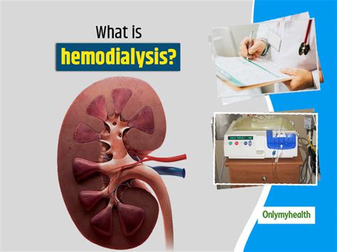 All About Hemodialysis: Procedure, Complications, Advantages And ...