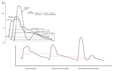 Drawing Waveform at PaintingValley.com | Explore collection of Drawing ...