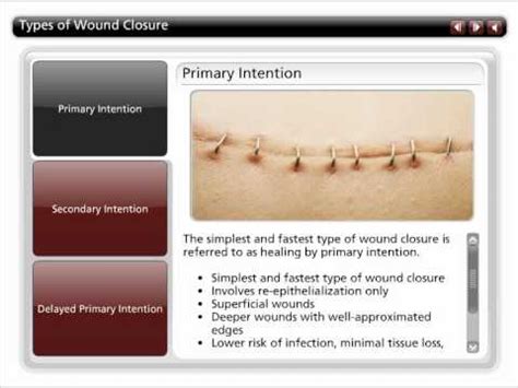 Types of Wound Closure - YouTube