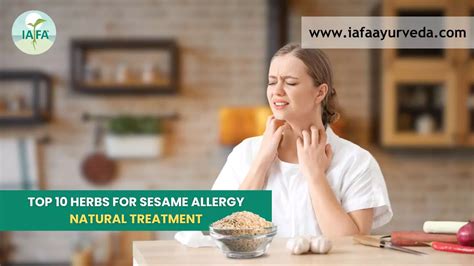 Top 10 Herbs for Sesame Allergy Natural Treatment