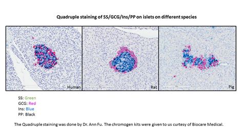 Quadruple IHC Stain » Molecular Pathology Core » College of Medicine ...