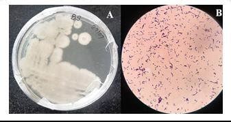 A) Colony morphology of Bacillus subtilis in nutrient agar. B) Bacillus ...