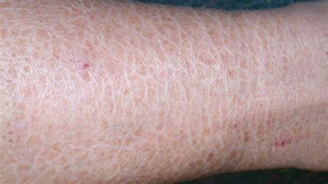 Itching: Pictures, Causes, Diagnosis, and Home Remedies