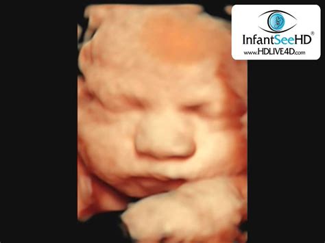 OMG HD LIVE 4D ULTRASOUND 30 WEEKS - YouTube