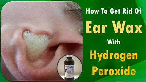 Draining Ear With Hydrogen Peroxide - Best Drain Photos Primagem.Org