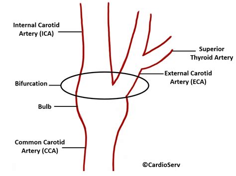 Carotid Artery Anatomy Cardioserv