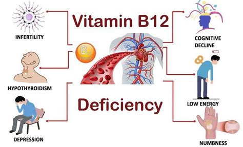 Vitamin B12 deficiency, causes, signs, symptoms, diagnosis, treatment ...