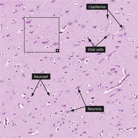 22 best images about Histology - Cerebrum on Pinterest | Different ...