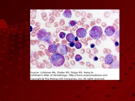 Myeloproliferative disorders