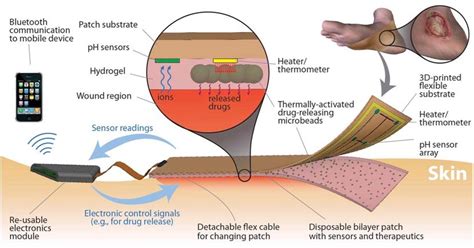 Smart Bandages Can Monitor, Treat Chronic Wounds | HowStuffWorks