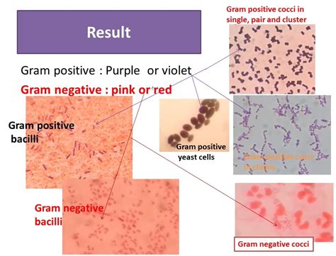 Gram Stain: Introduction, Principle, Procedure, Result and Interpretation