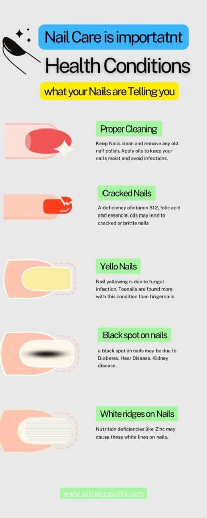 Everything you should know about the importance of nail care and their ...