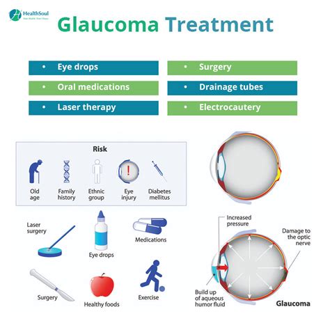 Glaucoma: Symptoms, Diagnosis and Treatment – Healthsoul